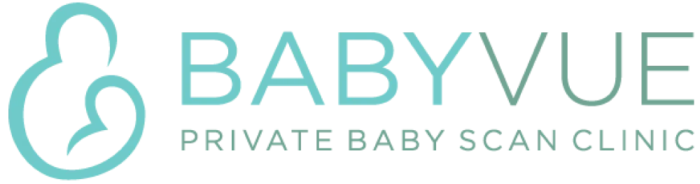 Babyvue