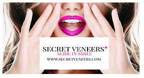 Secret Veneers